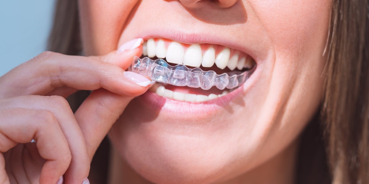 Ensuring Healthy Adult Teeth for Children: Dental Implants in Hertfordshire